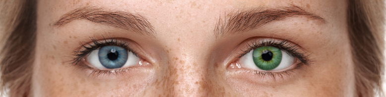  Die natürliche Augenfarbe verglichen mit der Augenfarbe bei deckenden Kontaktlinsen